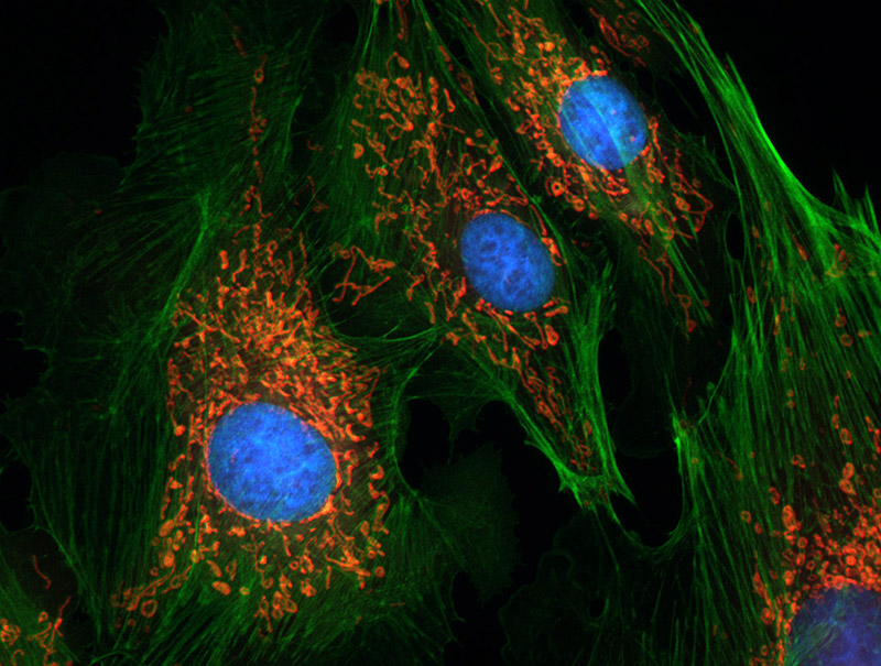 Fluoreszenzmikroskopische Aufnahme von Endothelzellen (Rinder-Lungenarterie)